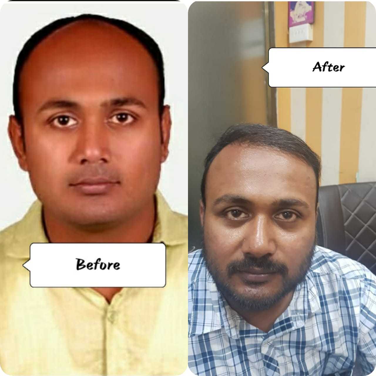 Hair Regrowth Consultation